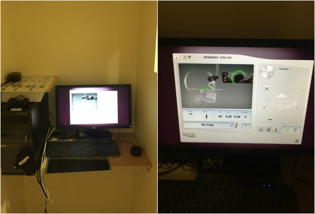 εγκατάσταση πανοραμικό egkatastasi cs8100 euromedica karditsa