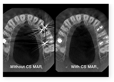Μοναδική τεχνολογία CS MAR