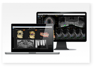 Απεικόνιση χαμηλής δόσης