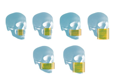 Έξι επιλέξιμα πεδία από 4x4cm ως 12x10cm