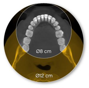 CS 8200 3D Extended field of view
