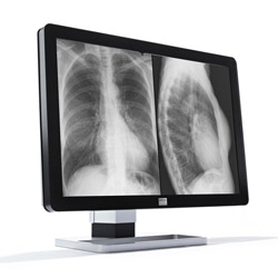 diagnostikes othones monitors-1