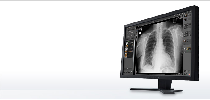 psifiopoiites-computed-radiography-Image-Suite-Software_p