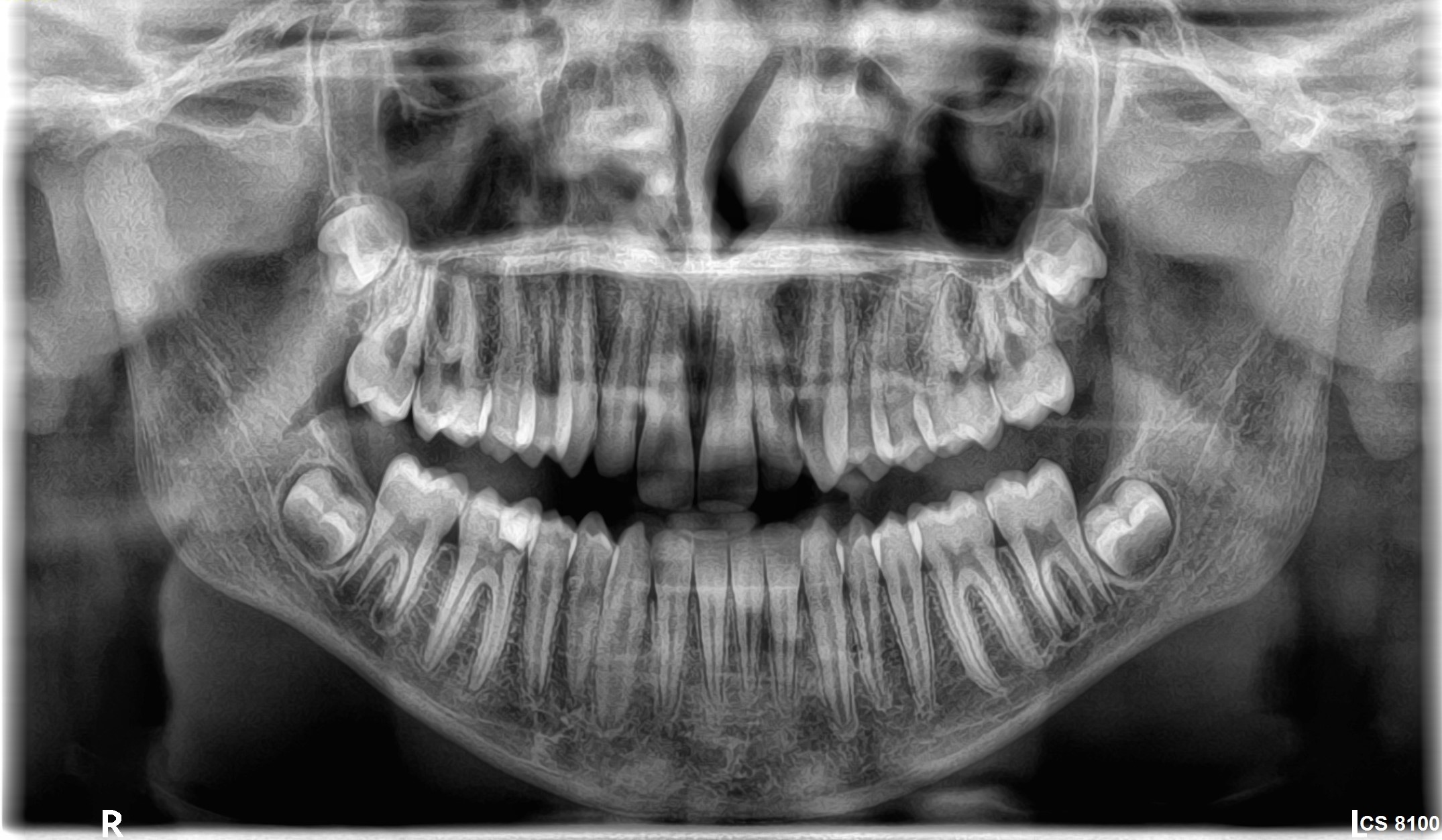 Κλινικές εικόνες cs8100