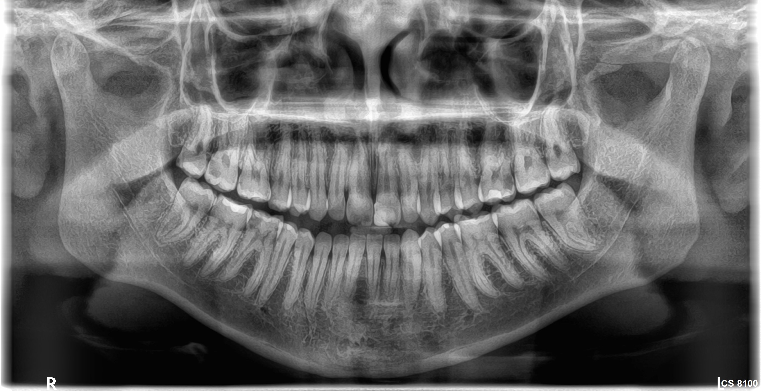 Κλινικές εικόνες cs8100