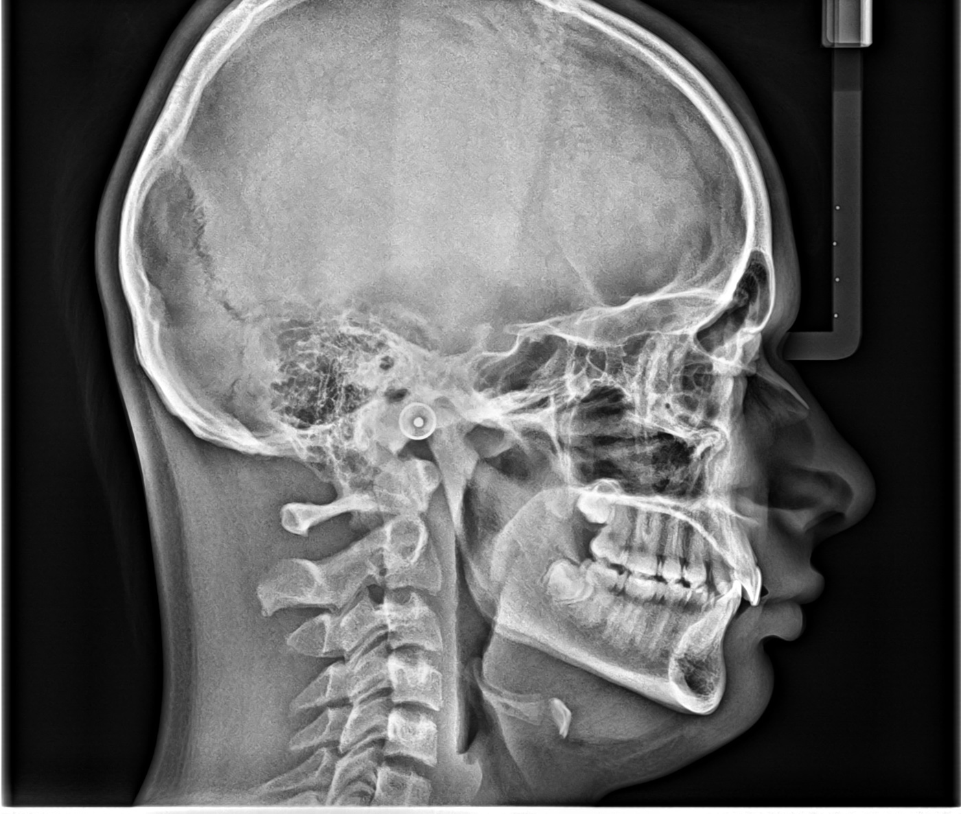 Κλινικές εικόνες για το cs8100sc