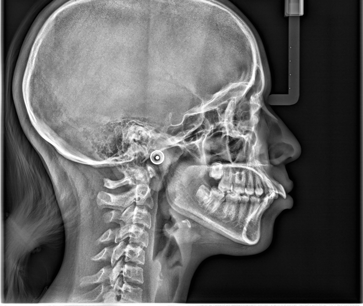 Κλινικές εικόνες για το cs8100sc