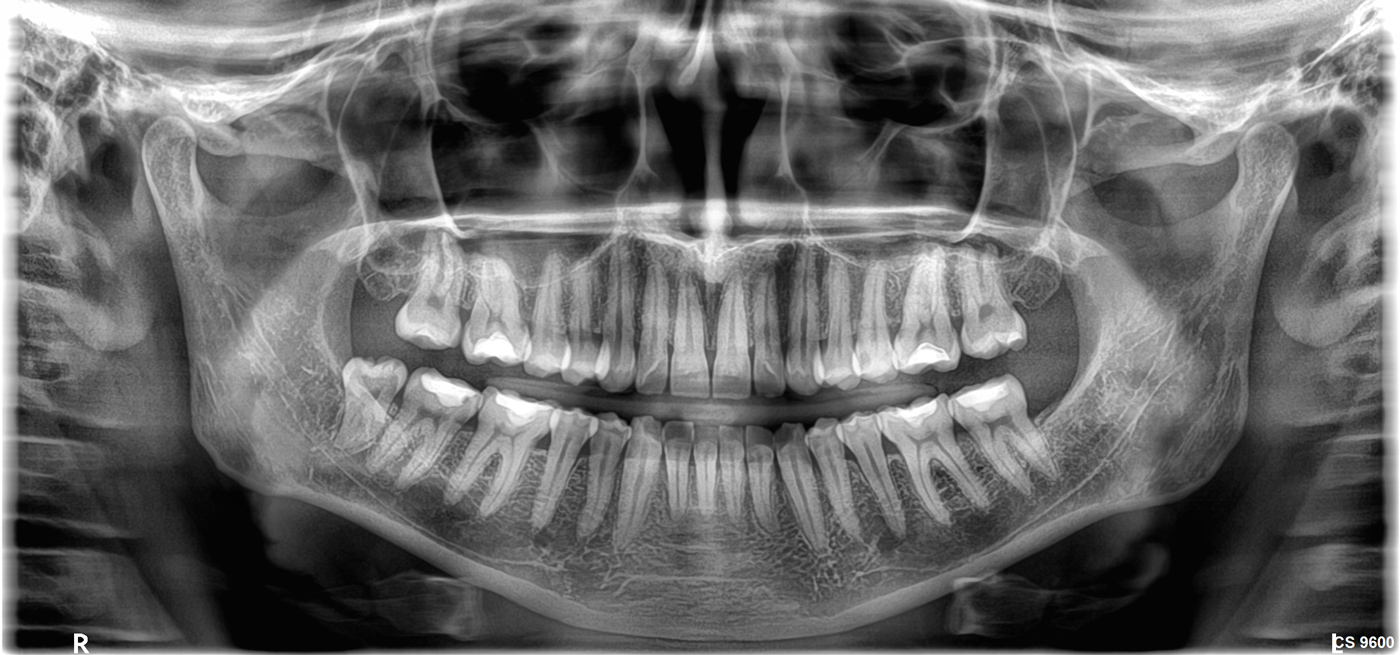 Κλινικές εικόνες cs9600