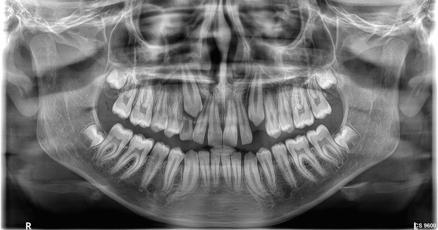 Κλινικές εικόνες cs9600
