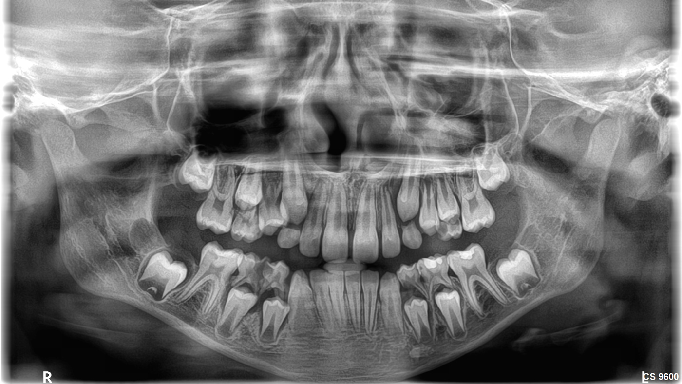 Κλινικές εικόνες cs9600