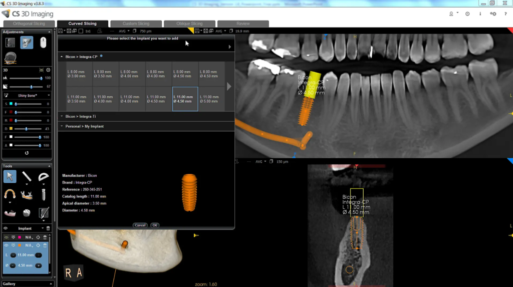 3D imaging software της Carestream Dental