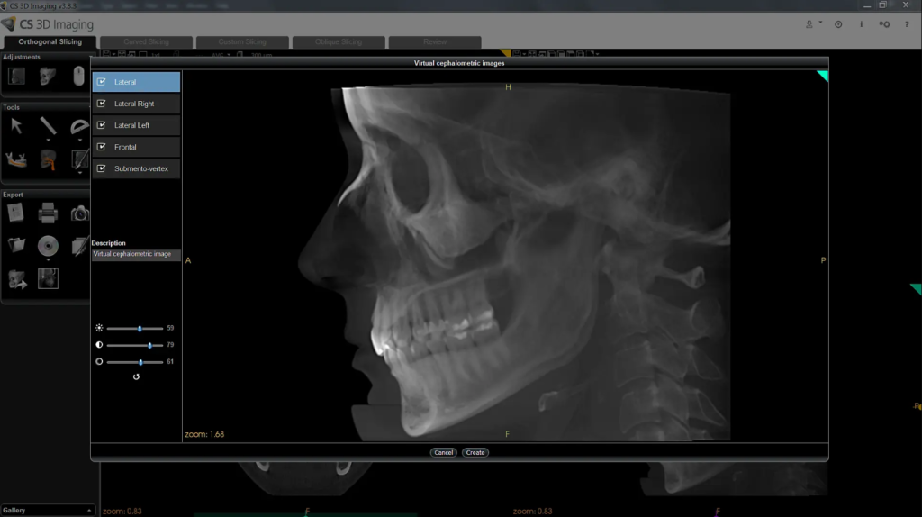 Δείγμα 1 3D imaging software της Carestream Dental