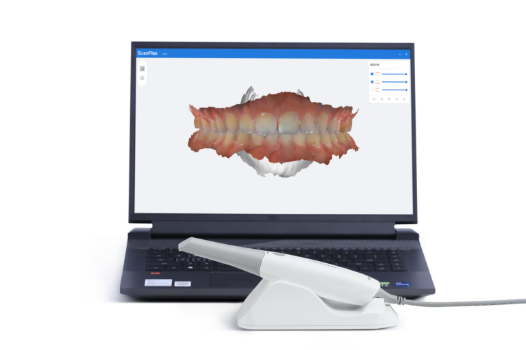 ενδοστοματικός σαρωτής