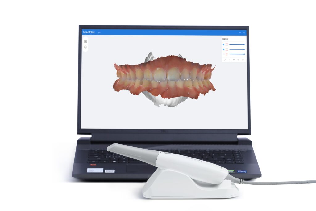 intraoral scanner with laptop